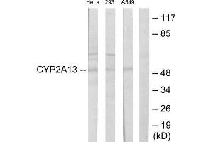 Western Blotting (WB) image for anti-Cytochrome P450, Family 2, Subfamily A, Polypeptide 13 (CYP2A13) (Internal Region) antibody (ABIN1850348)