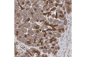 Immunohistochemical staining of human pancreas with SMAP2 polyclonal antibody  shows strong cytoplasmic positivity in pancreatic ducts. (SMAP2 anticorps)