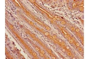 Immunohistochemistry of paraffin-embedded human small intestine tissue using ABIN7149259 at dilution of 1:100