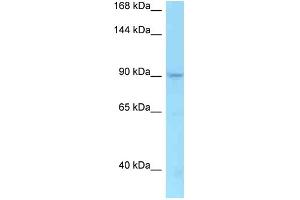 WB Suggested Anti-TMEM63A Antibody   Titration: 1. (TMEM63A anticorps  (C-Term))