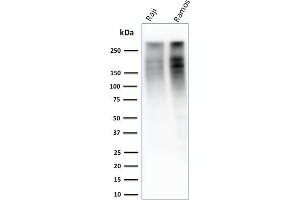 anti-Antigen Identified By Monoclonal Antibody Ki-67 (MKI67) (AA 2293-2478) antibody
