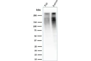 Western Blot Analysis of Raji and Ramos cell lysate using Ki67 Mouse Monoclonal Antibody (MKI67/2461). (Ki-67 anticorps  (AA 2293-2478))