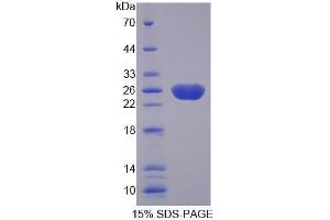 SDS-PAGE (SDS) image for Fibulin 3 (FBLN3) (AA 258-493) protein (His tag) (ABIN1170447) (FBLN3 Protein (AA 258-493) (His tag))