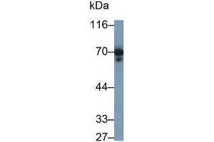 Detection of PTPRO in Rat Cerebrum lysate using Polyclonal Antibody to Protein Tyrosine Phosphatase Receptor Type O (PTPRO)