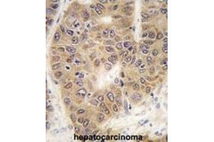 Immunohistochemistry (IHC) image for anti-Small Ubiquitin Related Modifier 4 (SUMO4) (M55V) antibody (ABIN2996873)