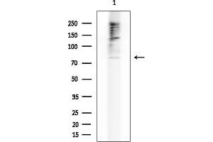 Western blot analysis of lysates from Mouse testis, using ABCG8 Antibody at 1/1000 dilution.