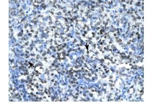 Claudin 17 antibody was used for immunohistochemistry at a concentration of 4-8 ug/ml to stain Spleen cells (arrows) in Human Spleen.