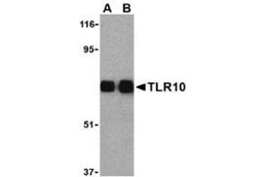 Western blot analysis of TLR10 in human lymph node cell lysates with this product at (A) 0.