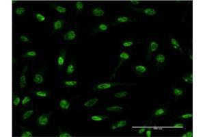 Immunofluorescence of monoclonal antibody to CDR2 on HeLa cell. (CDR2 anticorps  (AA 1-454))