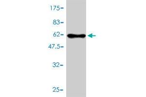 Western Blot detection against Immunogen (61.
