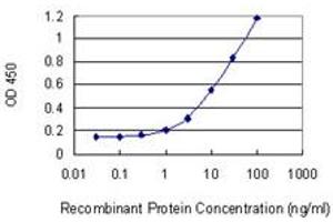 Detection limit for recombinant GST tagged PRKCDBP is 0. (PRKCDBP anticorps  (AA 161-261))