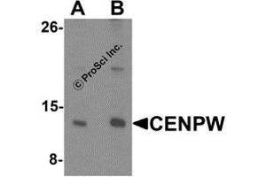 Western Blotting (WB) image for anti-Centromere Protein W (CENPW) (N-Term) antibody (ABIN1587944) (CENPW anticorps  (N-Term))