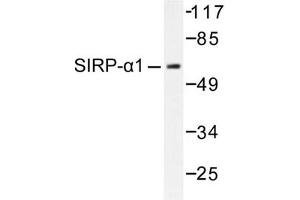 Image no. 1 for anti-Signal-Regulatory Protein alpha (SIRPA) antibody (ABIN271815) (SIRPA anticorps)