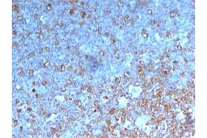 IHC testing of human tonsil stained with Cdk1 antibody. (CDK1 anticorps)