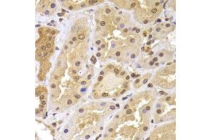 Immunohistochemistry of paraffin-embedded human kidney using PHF21B antibody at dilution of 1:100 (40x lens). (PHF21B anticorps)