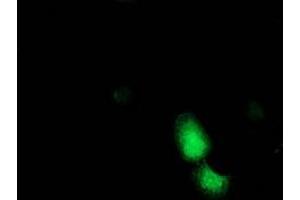 Immunofluorescence (IF) image for anti-Alcohol Dehydrogenase 1B (Class I), beta Polypeptide (ADH1B) antibody (ABIN1496477)