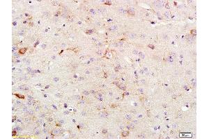Formalin-fixed and paraffin embedded rat brain labeled with Anti KSR1 Polyclonal Antibody, Unconjugated (ABIN700645) at 1:200 followed by conjugation to the secondary antibody and DAB staining (KSR1 anticorps  (AA 601-750))