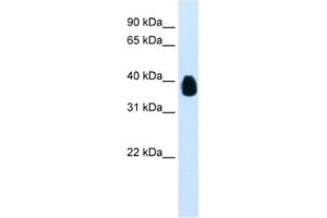 Western Blotting (WB) image for anti-Ets Variant 7 (ETV7) antibody (ABIN2461239) (ETV7 anticorps)