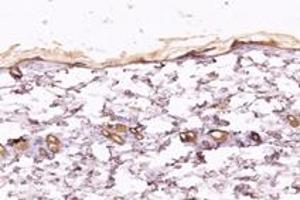 Immunohistochemistry analysis of paraffin-embedded rat heart using,KIF5B (ABIN7074440) at dilution of 1: 1000