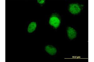 Immunofluorescence of purified MaxPab antibody to POLB on HeLa cell. (POLB anticorps  (AA 1-335))