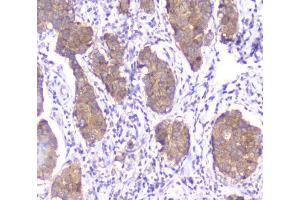 IHC analysis of SMN1/2 using anti-SMN1/2 antibody (ABIN5693315).