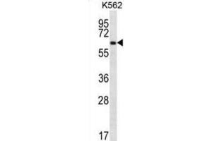 Western Blotting (WB) image for anti-Zinc Finger Protein 623 (ZNF623) antibody (ABIN2996914) (ZNF623 anticorps)
