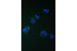 IF analysis of TIMM17A using anti-TIMM17A antibody (ABIN6719637).