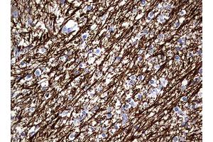 Image no. 2 for anti-Neurofilament, Light Polypeptide (NEFL) (AA 1-360) antibody (ABIN1490762) (NEFL anticorps  (AA 1-360))