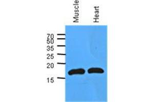Image no. 2 for anti-Myoglobin (MB) (AA 1-154), (N-Term) antibody (ABIN953585) (Myoglobin anticorps  (N-Term))