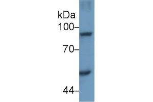 Detection of STAT4 in Human Hela cell lysate using Polyclonal Antibody to Signal Transducer And Activator Of Transcription 4 (STAT4)