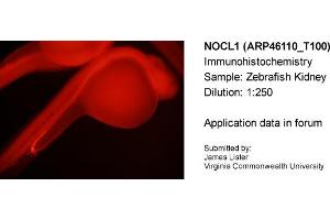 Sample Type: Zebrafish KidneyDilution: 1:250 (NOLC1 anticorps  (C-Term))