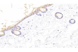 Detection of KL in Rat Skin Tissue using Polyclonal Antibody to Klotho (KL) (Klotho anticorps  (AA 517-956))