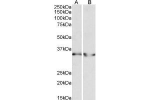 ABIN1782167 (0. (LDHB anticorps  (AA 15-25))