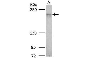 WB Image MRCK alpha antibody detects CDC42BPA protein by Western blot analysis. (CDC42BPA anticorps)