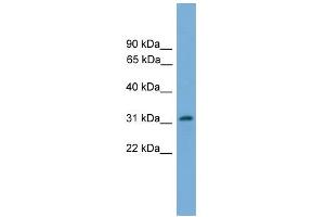 WB Suggested Anti-PIGL Antibody Titration:  0. (PIGL anticorps  (N-Term))