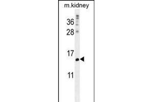 MORN5 Antibody (C-term) (ABIN656139 and ABIN2845478) western blot analysis in mouse kidney tissue lysates (35 μg/lane). (MORN5 anticorps  (C-Term))