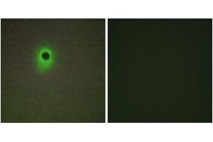 Immunofluorescence analysis of A549 cells, using HIPK4 Antibody.