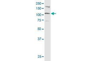 CTNND2 monoclonal antibody (M01), clone 6E11.