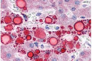 Human Liver, Lipid Droplets: Formalin-Fixed, Paraffin-Embedded (FFPE) (ADRP anticorps  (AA 28-281))