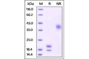 Human VEGF121, His Tag on SDS-PAGE under reducing (R) and no-reducing (NR) conditions.