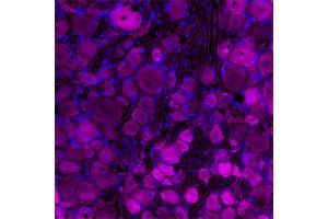 100 nM of α-Bungarotoxin-ATTO  was applied for 60 minutes at 37ºC, resulting in a violet fluorescence allowing observation of α-Bungarotoxin in DRG cells. (alpha-Bungarotoxin (Active) protein (Atto 647N))