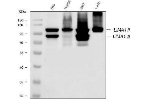 Western blot analysis of EPLIN/LIMA1 using anti-EPLIN/LIMA1 antibody (ABIN7602639).
