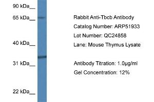 Western Blotting (WB) image for anti-Tubulin Folding Cofactor B (TBCB) (N-Term) antibody (ABIN2784694) (TBCB anticorps  (N-Term))