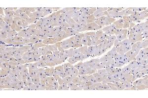 Detection of SEMA5B in Human Cardiac Muscle Tissue using Monoclonal Antibody to Semaphorin 5B (SEMA5B)