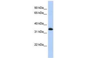 Image no. 1 for anti-Zinc Finger Protein 511 (ZNF511) (N-Term) antibody (ABIN6740520) (ZNF511 anticorps  (N-Term))