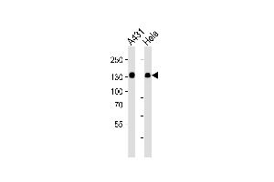 Western blot analysis of lysates from A431, Hela cell line (from left to right), using GTF2I Antibody at 1:1000 at each lane. (GTF2I anticorps  (C-Term))