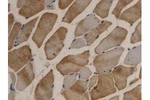 Detection of APOB in Rat Skeletal muscle Tissue using Polyclonal Antibody to Apolipoprotein B (APOB)