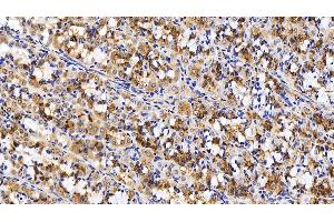 Detection of KNG1 in Human Stomach Tissue using Polyclonal Antibody to Kininogen 1 (KNG1)