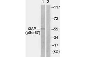 Western blot analysis of extracts from HepG2 cells treated with Anisomycin 25ug/ml 30', using XIAP (Phospho-Ser87) Antibody. (Intestinal Alkaline Phosphatase anticorps  (pSer87))