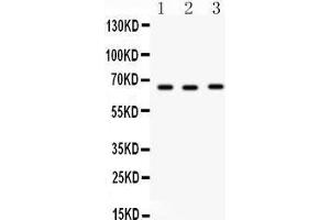 Observed bind size: 65KD (SLC19A1 anticorps  (Middle Region))